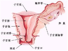 幼稚子宫