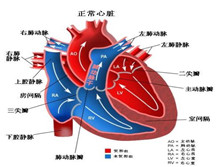 特发性肺动脉高压