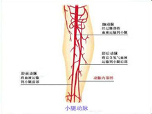 小腿动脉损伤