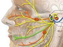 面神经损伤