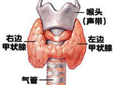 甲状腺功能减退症