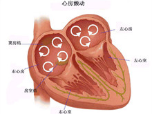 永久性房颤