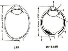 小角膜