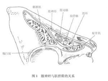 股神经卡压综合征