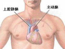 完全性肺静脉异位回流