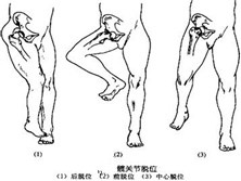 髋关节后脱位