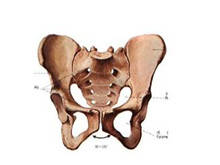 骨盆狭窄