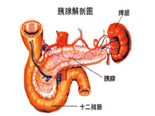 胰腺损伤