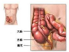 肠扭转综合征