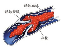 抗活化的蛋白C症