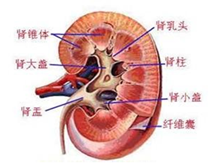 微小病变型肾病