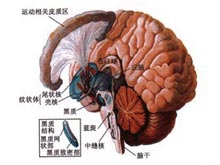 脑萎缩