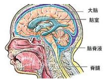 脑脊液鼻漏