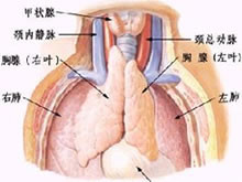 先天性胸腺发育不良