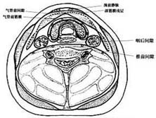 气管前间隙感染