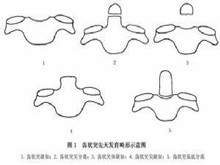 枢椎齿状突畸形