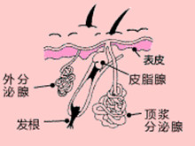 化脓性汗腺炎