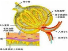 脂蛋白肾小球病