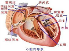 病态窦房结综合征