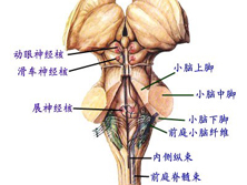 前庭神经炎