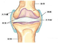 骨与关节结核