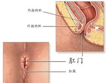 肛门外伤