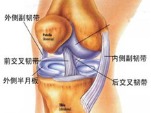 膝关节半月板损伤