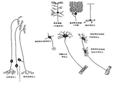 原发性侧索硬化