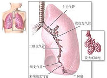 老年支原体肺炎