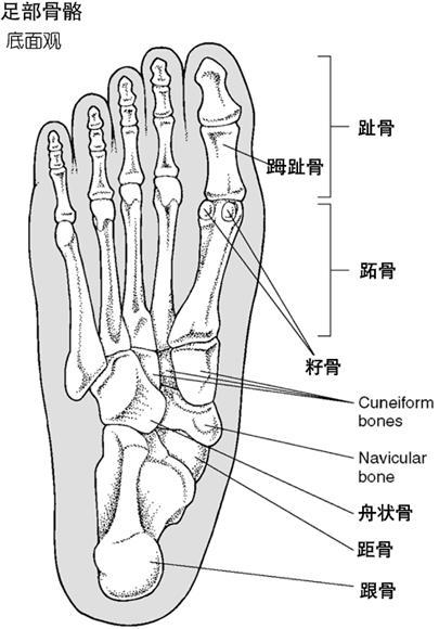 跖趾关节痛