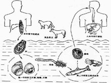 华支睾吸虫病