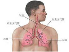 单纯性肺嗜酸性粒细胞增多症