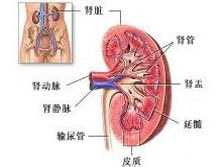 妊娠合并急性肾盂肾炎