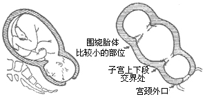 子宫收缩过强