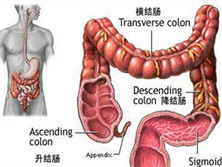 大肠恶性淋巴瘤