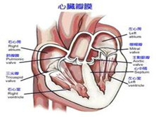 心脏瓣膜性疾病