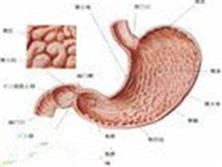 蛋白丧失胃肠综合征