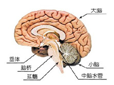 单发脑梗死性痴呆