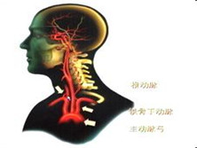 短暂性大脑缺血性发作