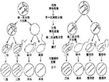 多巴反应性肌张力障碍