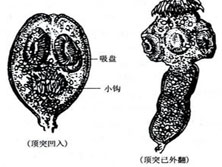 乳房棘球蚴病