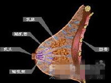 化脓性乳腺炎