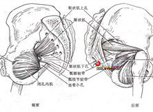 梨状肌症候群