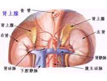 原发性醛固酮增多症