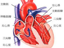 三尖瓣闭锁不全