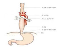 食管蹼和食管环