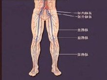 原发性下肢静脉瓣膜关闭不全