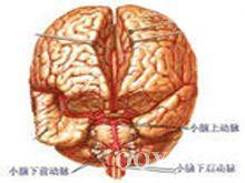 胰腺脑病综合征