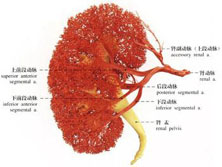 肾动脉粥样栓塞