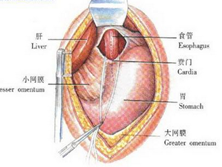 小儿贲门失弛缓症